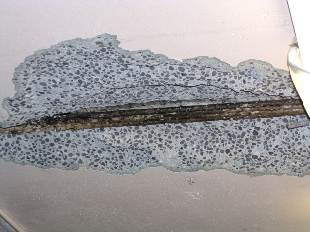 Concrete spalling at the mid-span of a post tension slab caused by insufficient cover over the tendon cable.